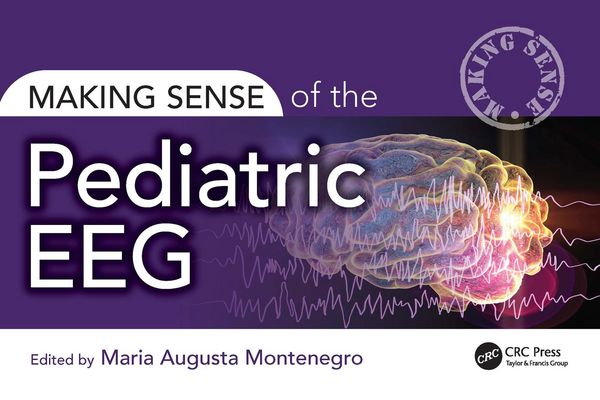 Produktbild: Making Sense of the Pediatric EEG