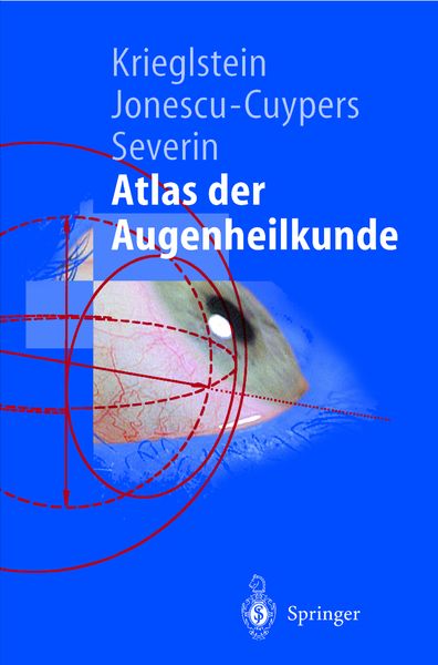 Atlas der Augenheilkunde, Taschenbuch von Günter K. Krieglstein , Christian P. Jonescu-Cuypers , Maria Severin, Springer Berlin, 9783540640011