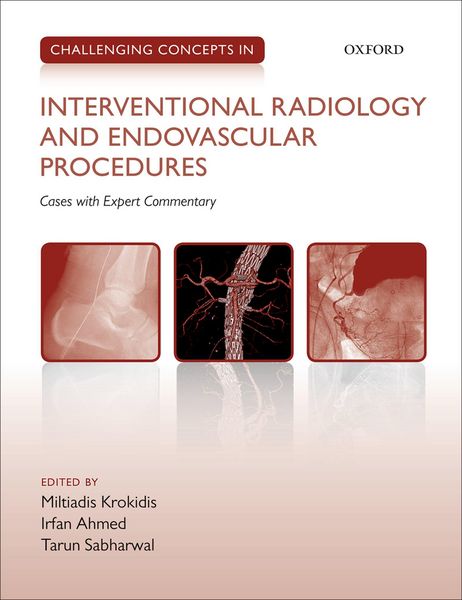 Produktbild: Challenging Concepts in Interventional Radiology