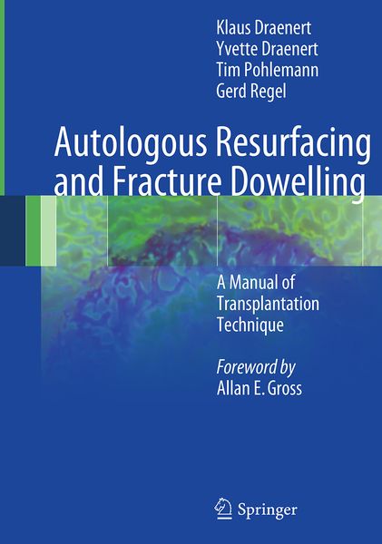 Produktbild: Autologous Resurfacing and Fracture Dowelling