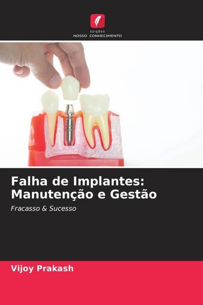 Produktbild: Falha de Implantes: Manuten&ccedil;&atilde;o e Gest&atilde;o