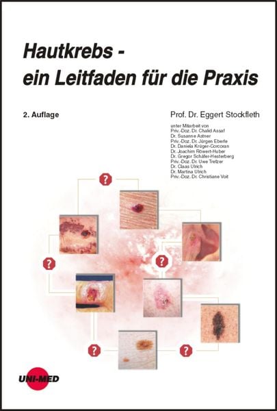 Produktbild: Hautkrebs - ein Leitfaden für die Praxis