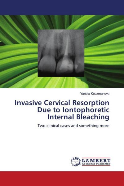 Produktbild: Invasive Cervical Resorption Due to Iontophoretic Internal Bleaching
