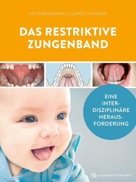 Produktbild: Das restriktive Zungenband