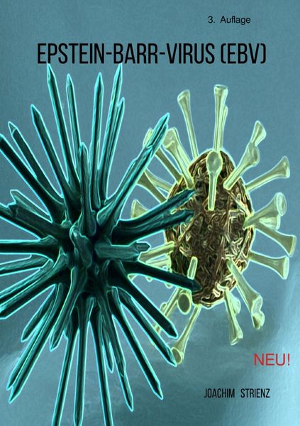 Produktbild: Epstein-Barr-Virus (EBV)