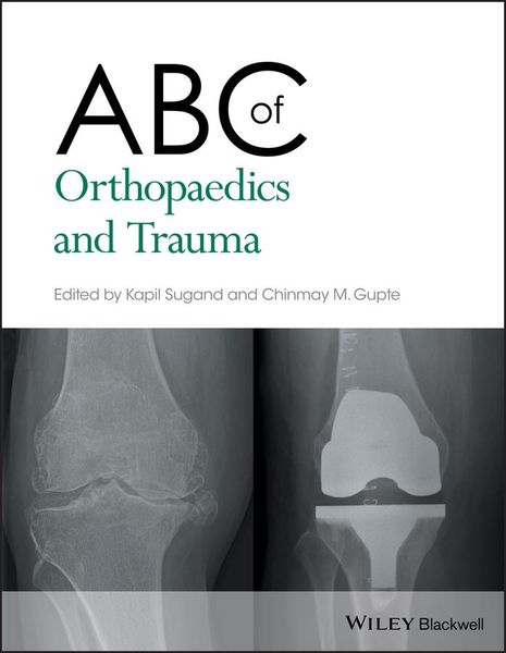 Produktbild: ABC of Orthopaedics and Trauma