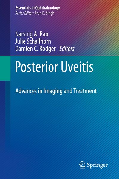 Produktbild: Posterior Uveitis
