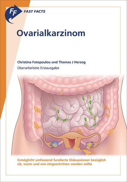 Produktbild: Fast Facts: Ovarialkarzinom
