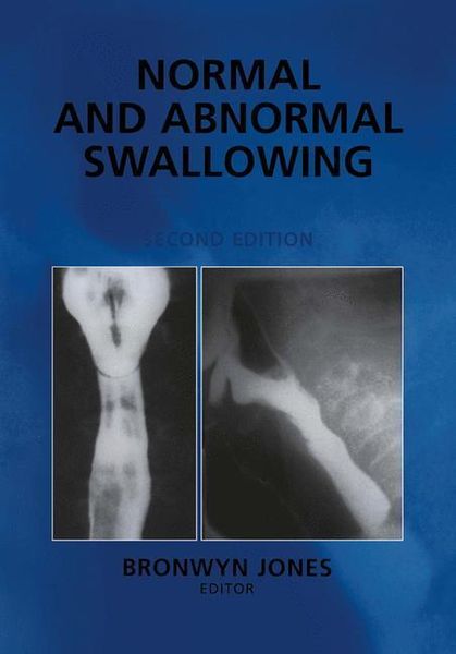 Produktbild: Normal and Abnormal Swallowing