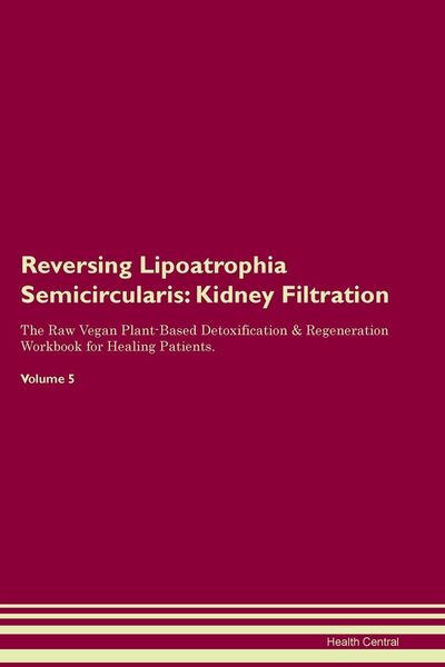Produktbild: Reversing Lipoatrophia Semicircularis