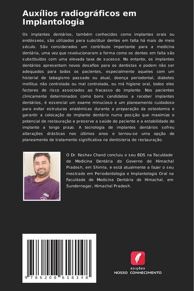 Produktbild: Aux&iacute;lios radiogr&aacute;ficos em Implantologia