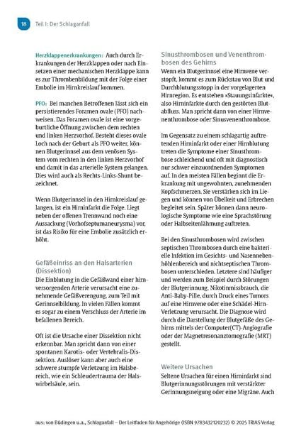 Produktbild: Schlaganfall - Der Leitfaden f&uuml;r Angeh&ouml;rige