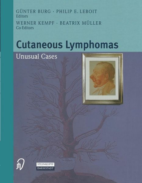 Produktbild: Cutaneous Lymphomas