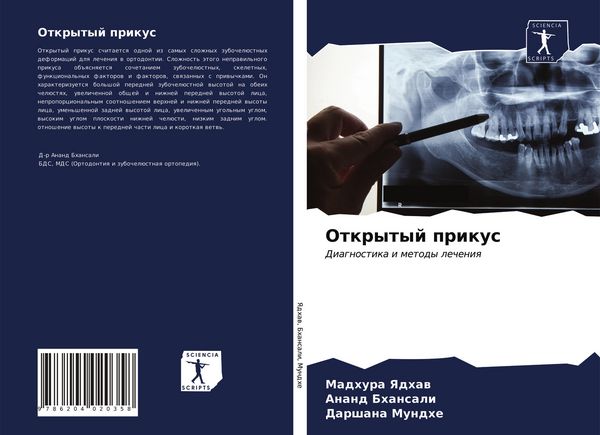Produktbild: Otkrytyj prikus