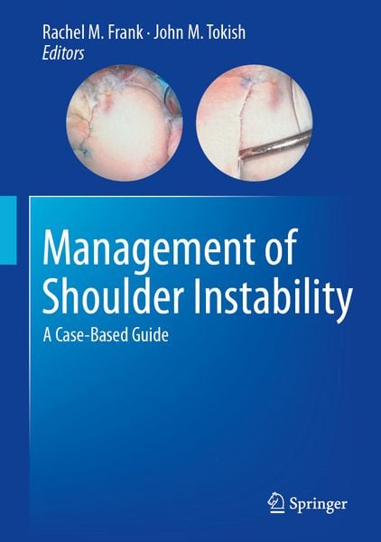 Produktbild: Management of Shoulder Instability
