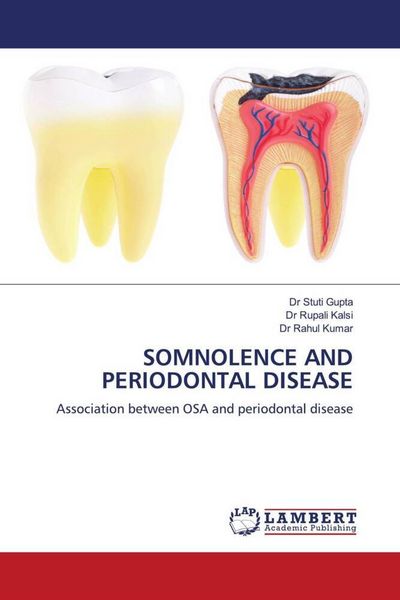 Produktbild: Somnolence and Periodontal Disease