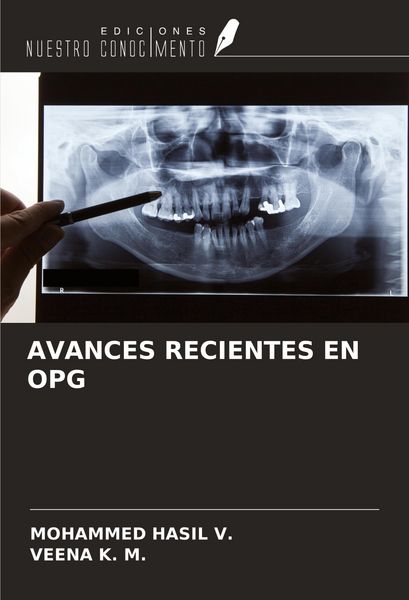 Produktbild: Avances Recientes En Opg