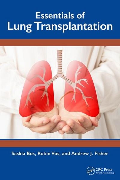 Produktbild: Essentials of Lung Transplantation