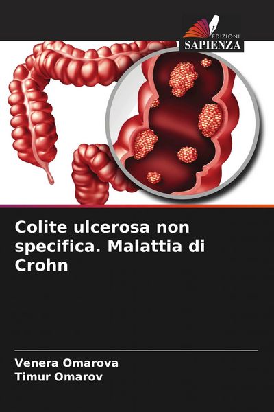 Produktbild: Colite ulcerosa non specifica. Malattia di Crohn