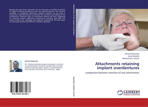 Produktbild: Attachments retaining implant overdentures
