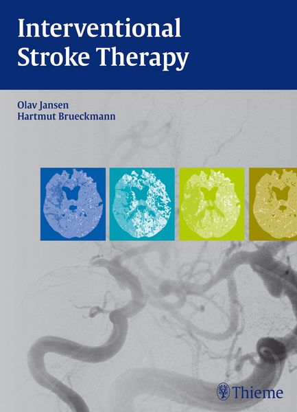Produktbild: Interventional Stroke Therapy