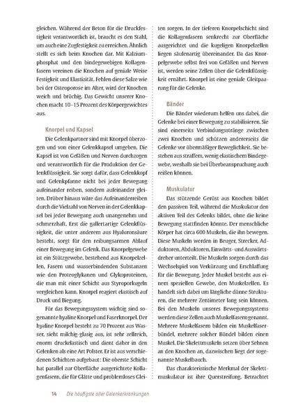 Produktbild: Expertenwissen: Arthrose