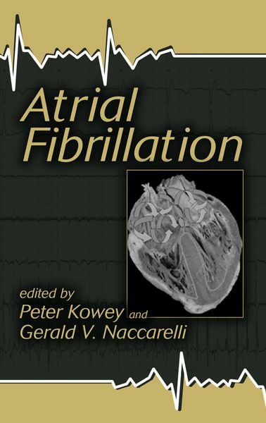 Produktbild: Atrial Fibrillation