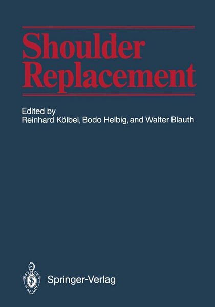 Produktbild: Shoulder Replacement