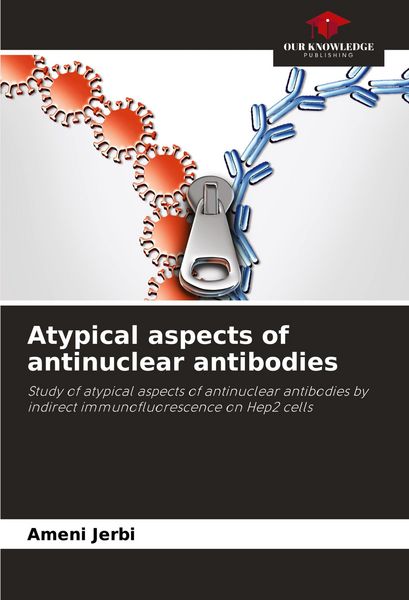 Produktbild: Atypical aspects of antinuclear antibodies