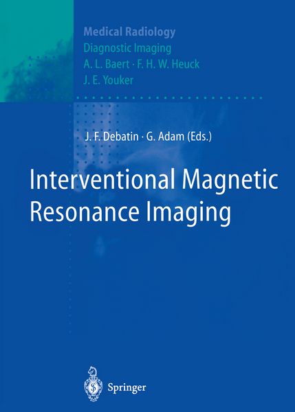 Produktbild: Interventional Magnetic Resonance Imaging