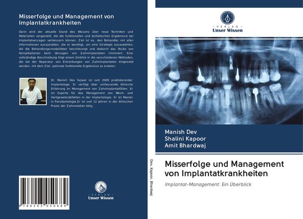 Produktbild: Misserfolge und Management von Implantatkrankheiten