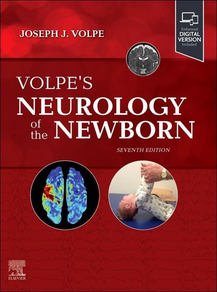 Produktbild: Volpe's Neurology of the Newborn