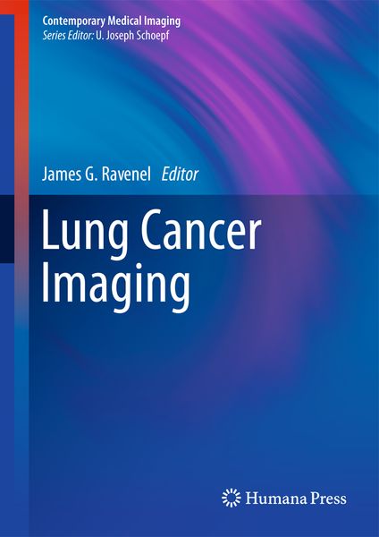 Produktbild: Lung Cancer Imaging