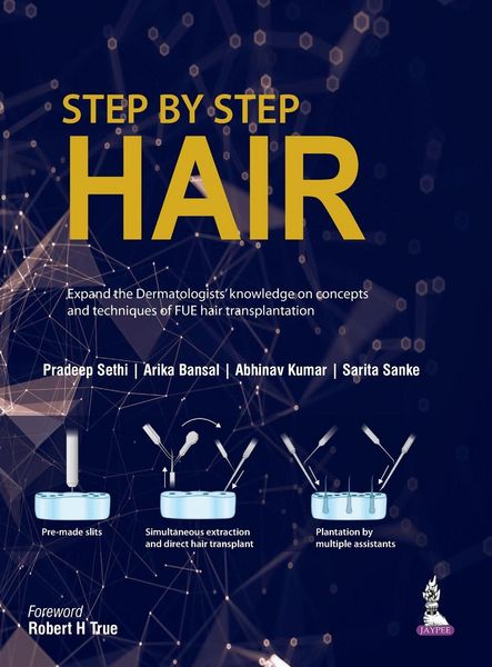 Produktbild: Step by Step Hair Transplantation