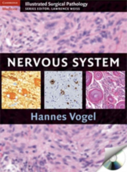 Produktbild: Nervous System