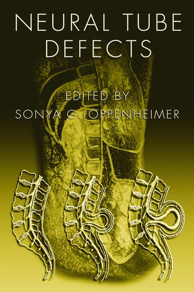 Produktbild: Neural Tube Defects