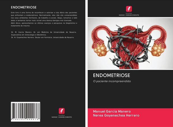 Produktbild: Endometriose