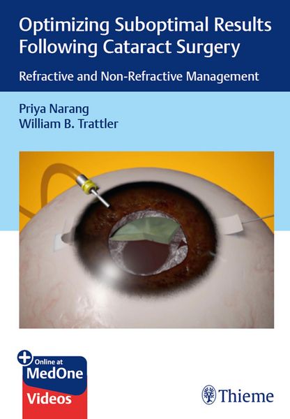 Produktbild: Optimizing Suboptimal Results Following Cataract Surgery