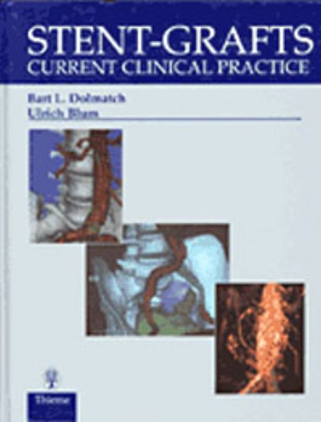 Produktbild: Stent-Grafts