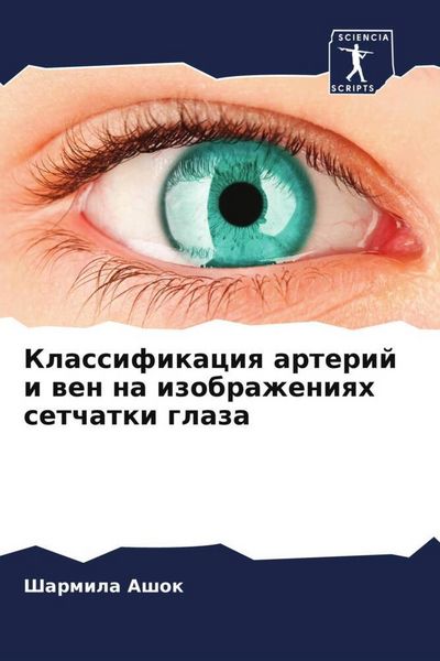 Produktbild: Klassifikaciq arterij i wen na izobrazheniqh setchatki glaza