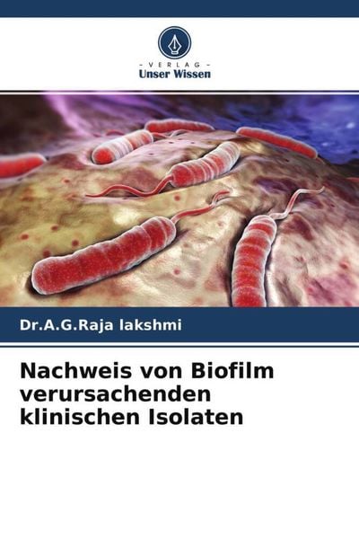 Nachweis von Biofilm verursachenden klinischen Isolaten, Taschenbuch von A. G. Raja Lakshmi , Puviyarasu Selvara, Verlag Unser Wissen, 9786204675473