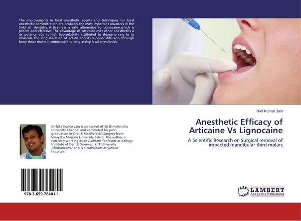 Produktbild: Anesthetic Efficacy of Articaine Vs Lignocaine