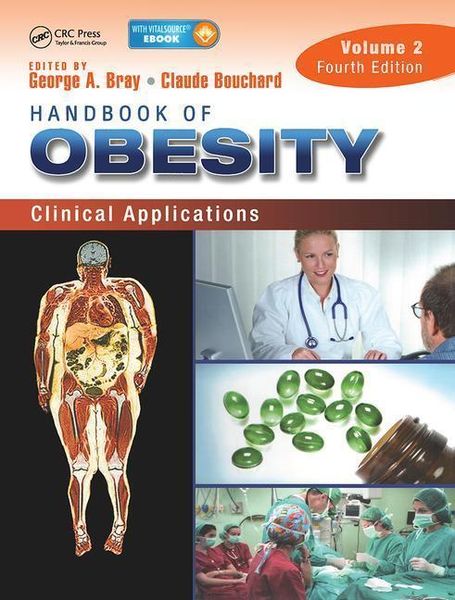 Produktbild: Bray, G: Handbook of Obesity - Volume 2