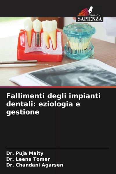 Produktbild: Fallimenti degli impianti dentali: eziologia e gestione