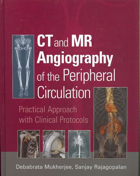 Produktbild: CT and MR Angiography of the Peripheral Circulation