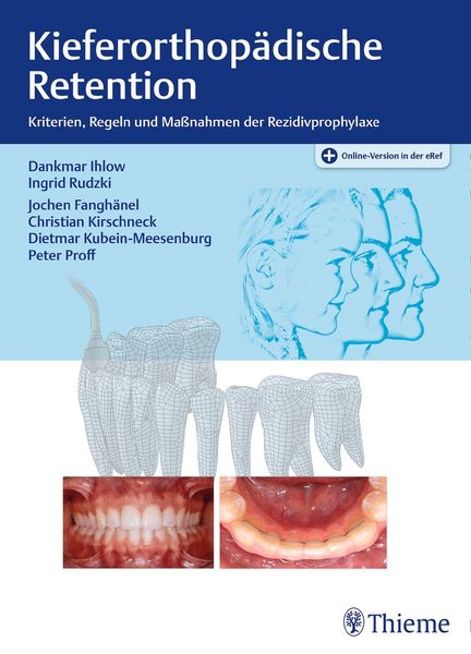 Produktbild: Kieferorthop&auml;dische Retention