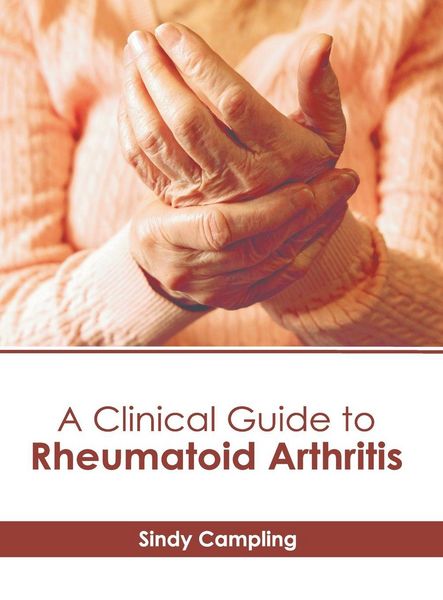 Produktbild: A Clinical Guide to Rheumatoid Arthritis