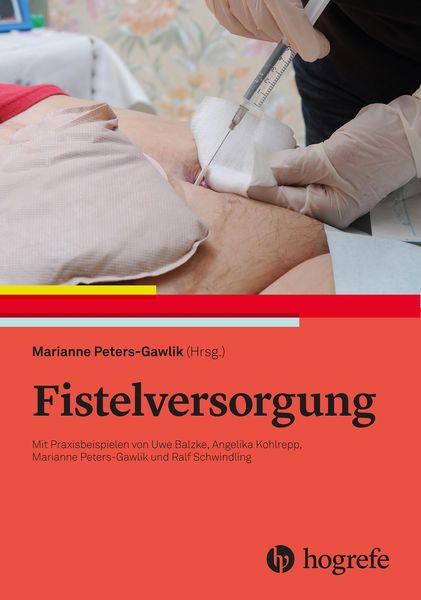 Produktbild: Fistelversorgung