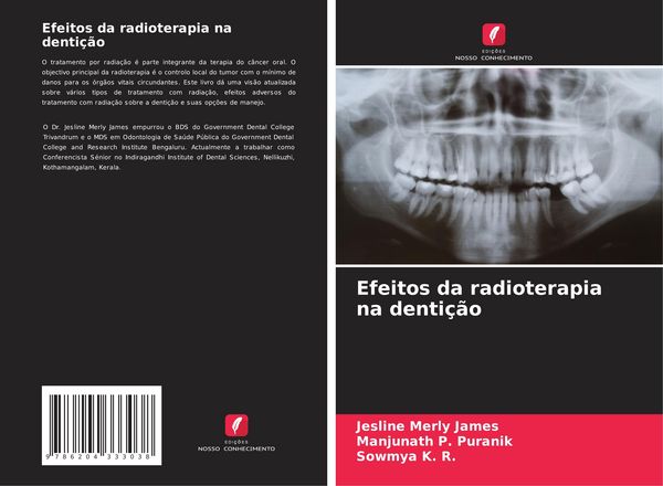 Produktbild: Efeitos da radioterapia na denti&ccedil;&atilde;o