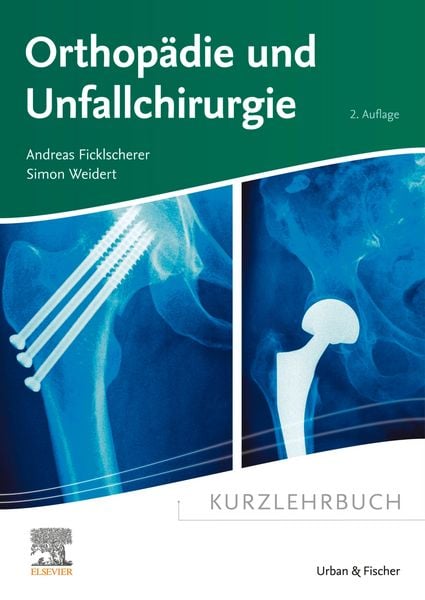 Produktbild: Kurzlehrbuch Orthop&auml;die und Unfallchirurgie